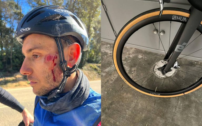Het gehavende gezicht van Jelle Geens en het gehavende voorwiel na zijn crash (foto's: Jelle Geens RR)